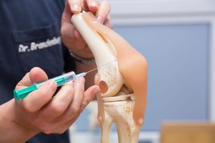 Arthrose-Therapie